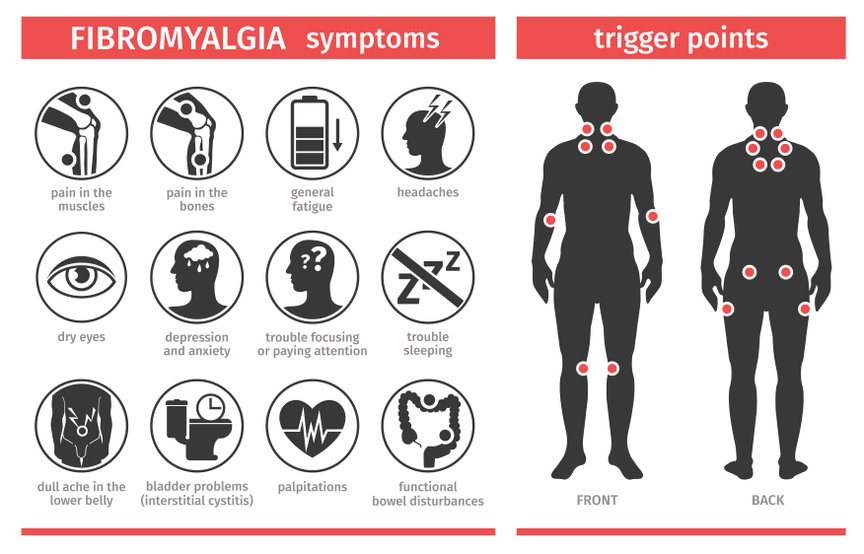 Fibromyalgi symptomer