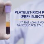 Video Thumbnail: Platelet-Rich Plasma (PRP) Injections | Q&A